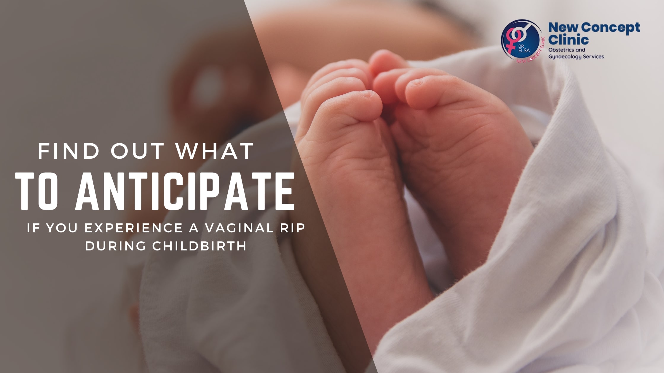 Find out what to anticipate if you experience a vaginal rip during childbirth 